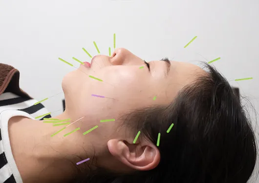 芦屋・神戸で薄毛・発毛のお悩み相談｜美容発毛ラボで鍼灸治療の初回カウンセリング