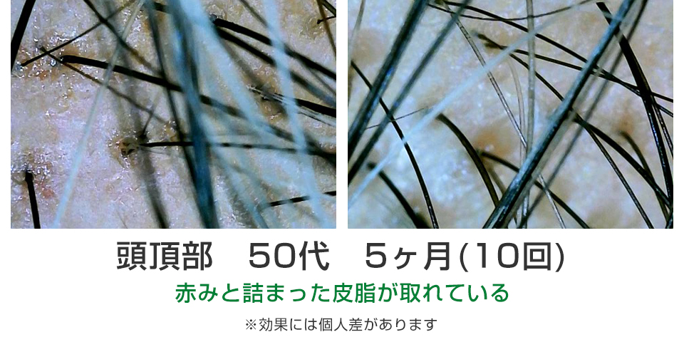 ビフォーアフター