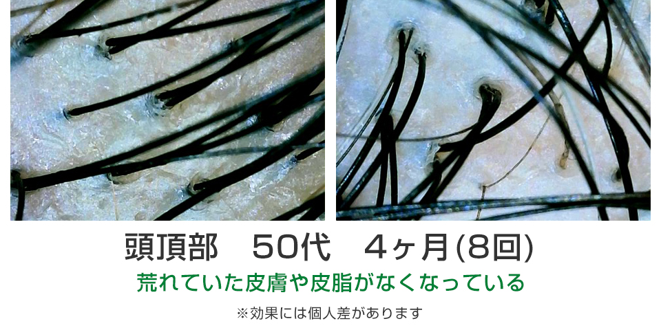 ビフォーアフター