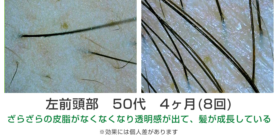 ビフォーアフター