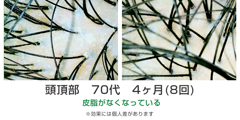 ビフォーアフター