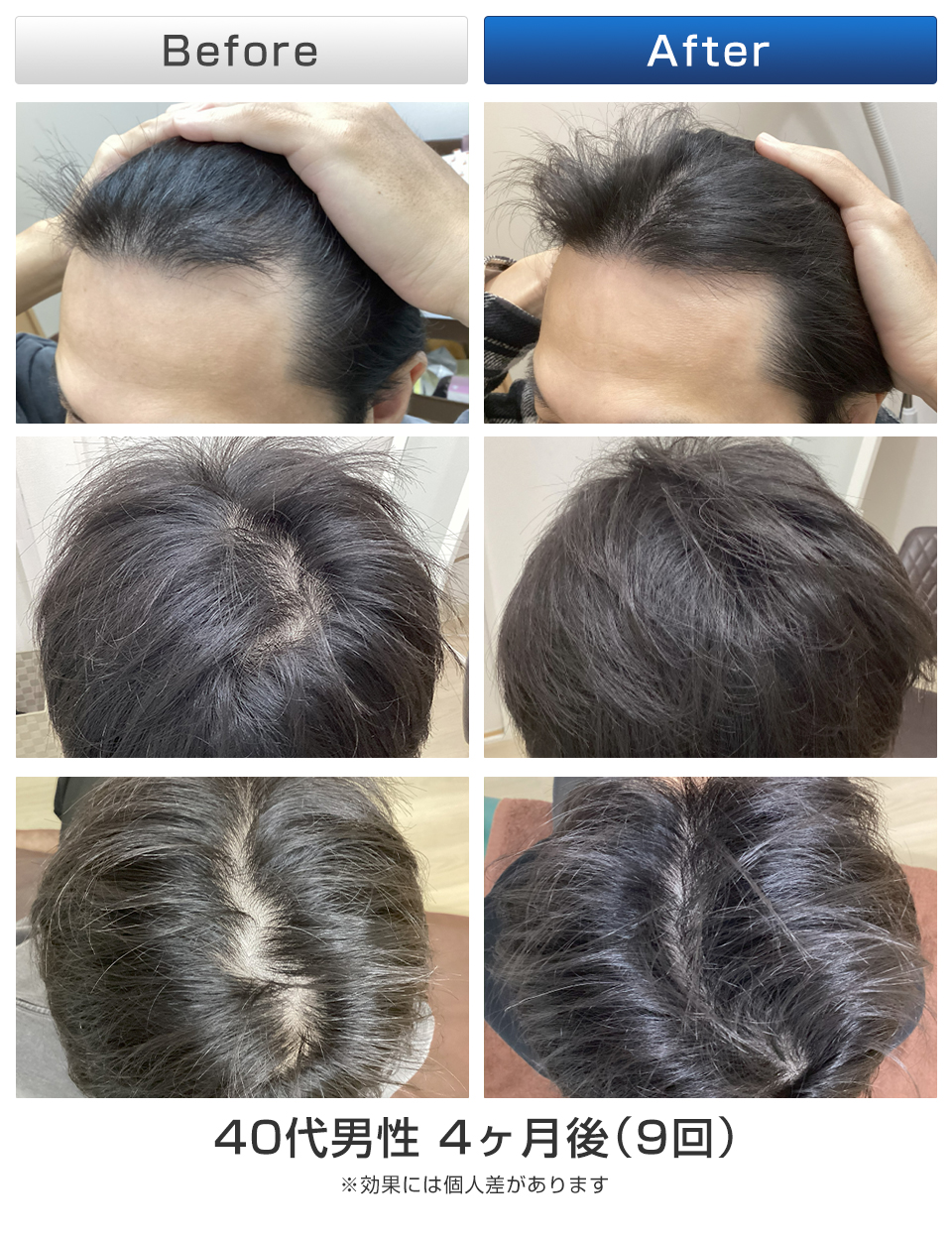 ビフォーアフター