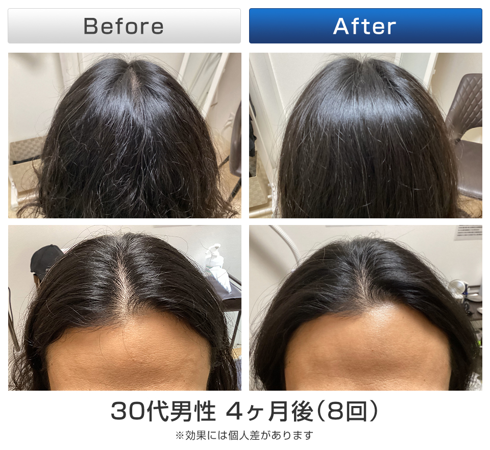 ビフォーアフター