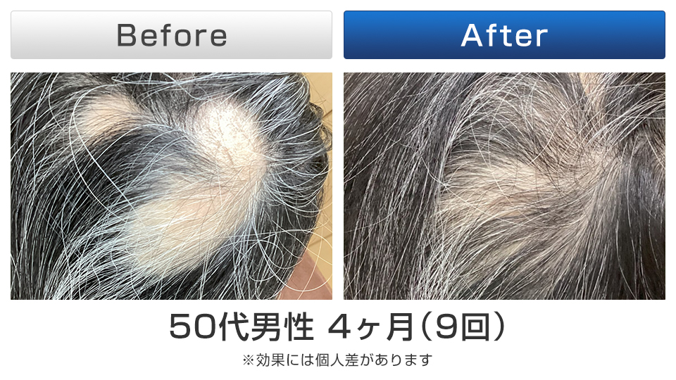 ビフォーアフター