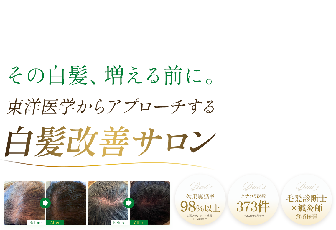 白髪