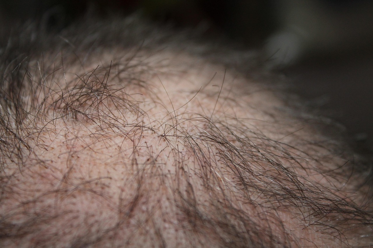 ヘアサイクルの乱れを鍼灸で整える｜成長期・退行期・休止期の仕組みと発毛促進